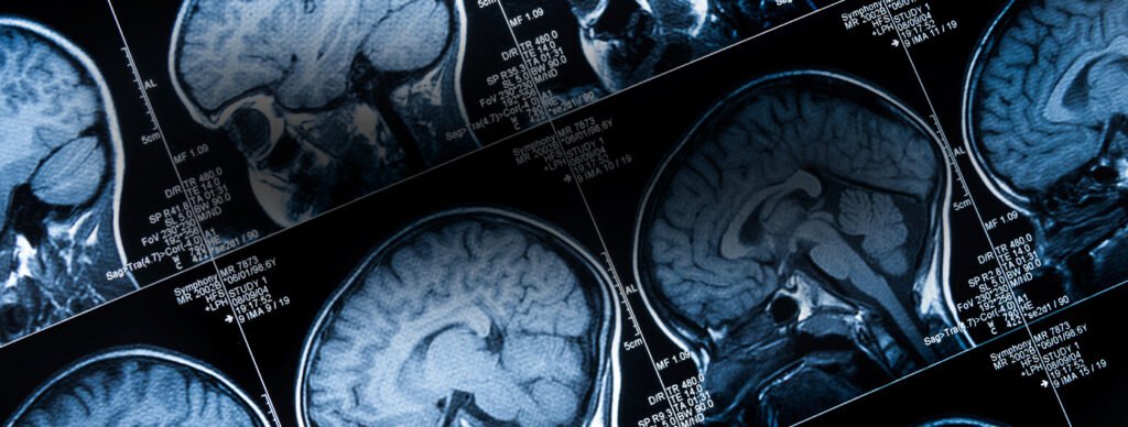 British Neuro-oncology Society