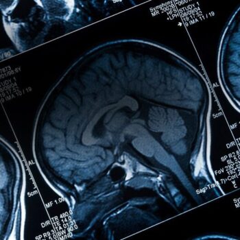 British Neuro-oncology Society